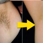 Belleza natural: 3 métodos caseros para reducir el vello corporal sin químicos