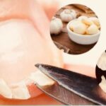 Elimina los Hongos en las Uñas en Segundos con este Remedio Natural