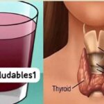 ¿Sufres de Tiroides?: Descubre Cómo Puedes Sanarte en Casa