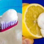 Cura Natural de Caries: Receta Completa para Reparar tus Dientes