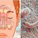 Remedios naturales para combatir la tos y eliminar la flema de los pulmones