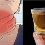¡Chau al Dolor de Garganta e Inflamación! El Poder del Antibiótico Natural