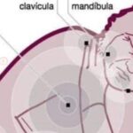Infarto en Mujeres: 7 Señales de Alerta que Muchas Ignoran