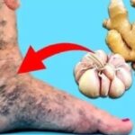 Cómo el ajo y el jengibre pueden ayudarte a aliviar las várices de forma natural