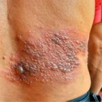 Descubriendo la Verdadera Causa de la Picazón Corporal: Un Viaje hacia el Diagnóstico
