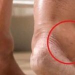 ¿Sabías que los pies hinchados pueden ser causados por estas diversas razones? Ten cuidado