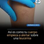 Síntomas de Cáncer en la Sangre: No Ignores Estas Señales