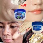 Transformación De Piel En 8 Días: ¡Descubre Mi Secreta Crema Casera!