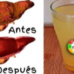 Revitaliza Tu Hígado: Secretos para que Funcione como el de una Adolescente