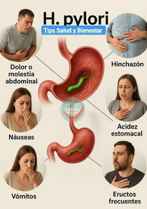 Helicobacter Pylori