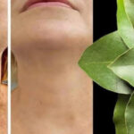 El Laurel: 100 Veces Más Potente que el Botos para Borrar Arrugas