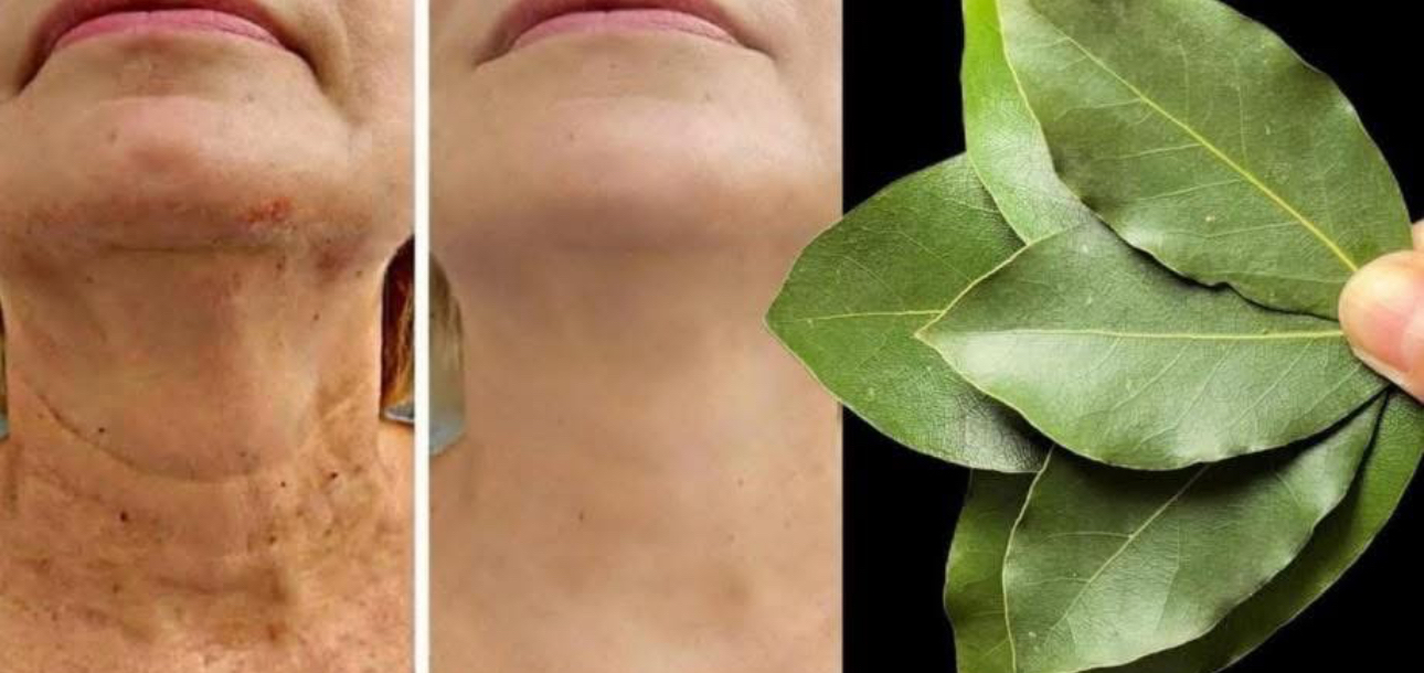 Beneficios del Laurel