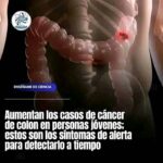 ¿Conoces los Síntomas del Cáncer de Colon? Descúbrelos Aquí