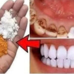 El Secreto Mejor Guardado de los Dentistas: Blanqueamiento Dental en Solo 2 Minutos