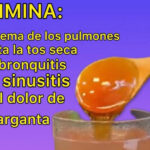 Descubre la Bebida Milagrosa que Elimina la Flema, la Tos Seca y Alivia la Bronquitis, Sinusitis y Dolor de Garganta