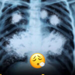 ¿Vaporizar o sufrir? Consecuencias del Vapeo en Jóvenes