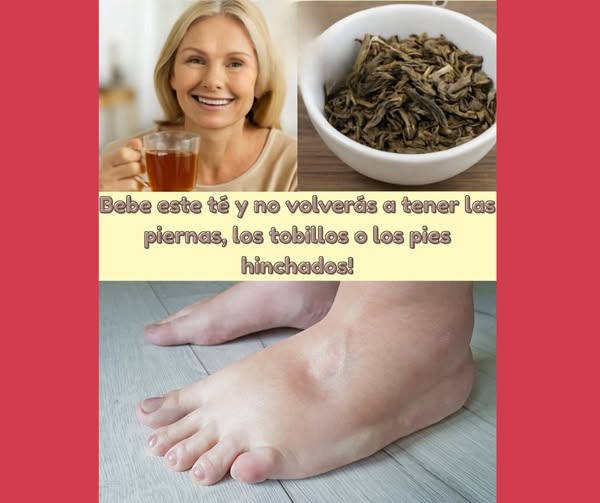 Té para reducir la hinchazón