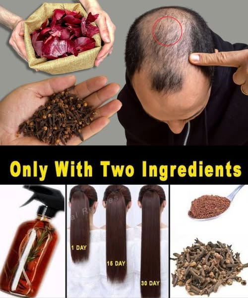 Cebolla roja y clavos de olor