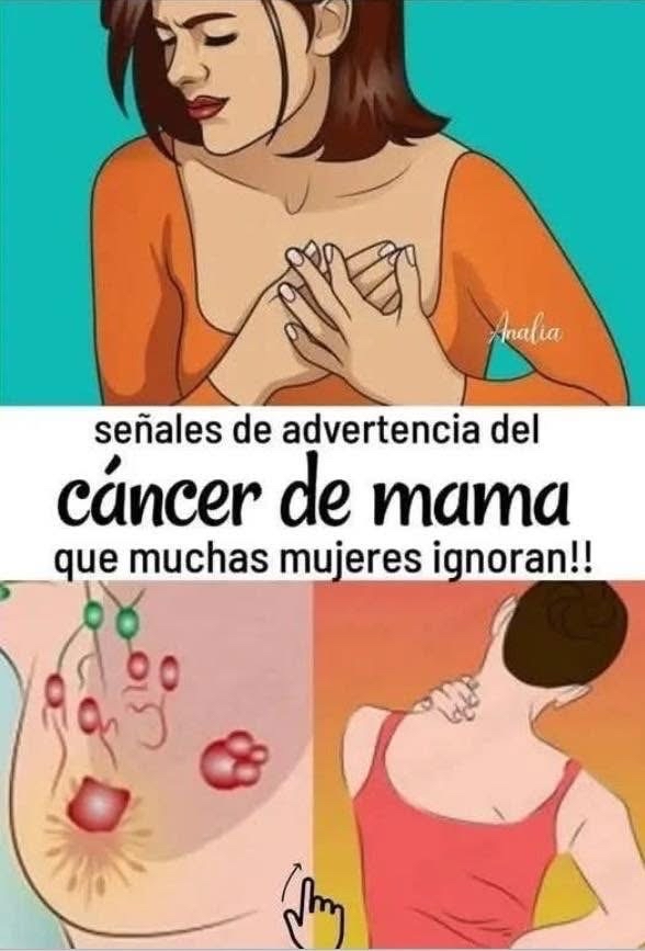Señales de advertencia del cáncer de mama