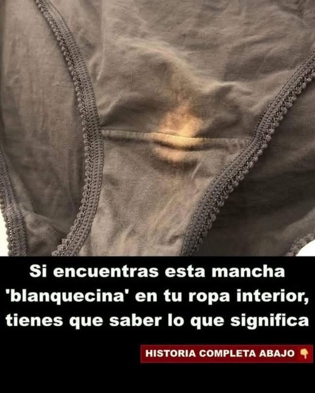 Mancha blanquecina en ropa interior