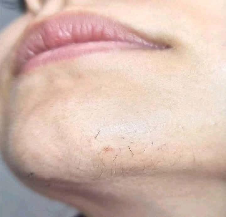 Detoxificación Natural