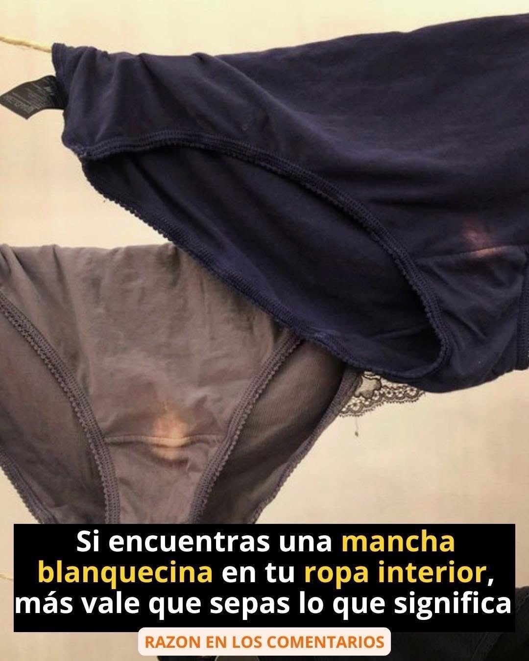 Manchas en la ropa interior femenina