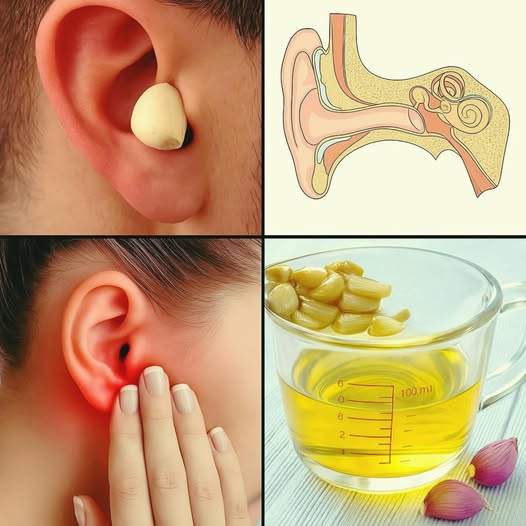 Uso del ajo como remedio natural para aliviar el dolor de oído