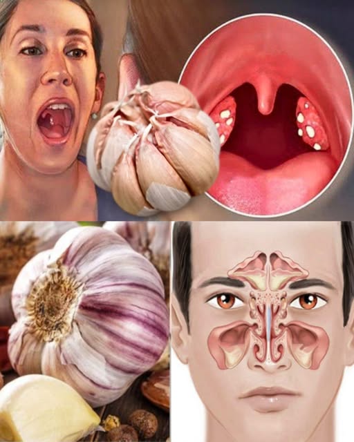 Uso del ajo en la salud