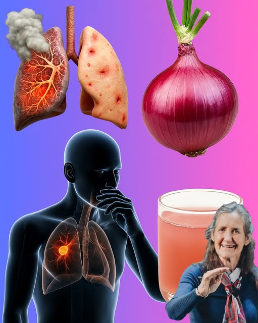 Remedios de cebolla para la salud pulmonar