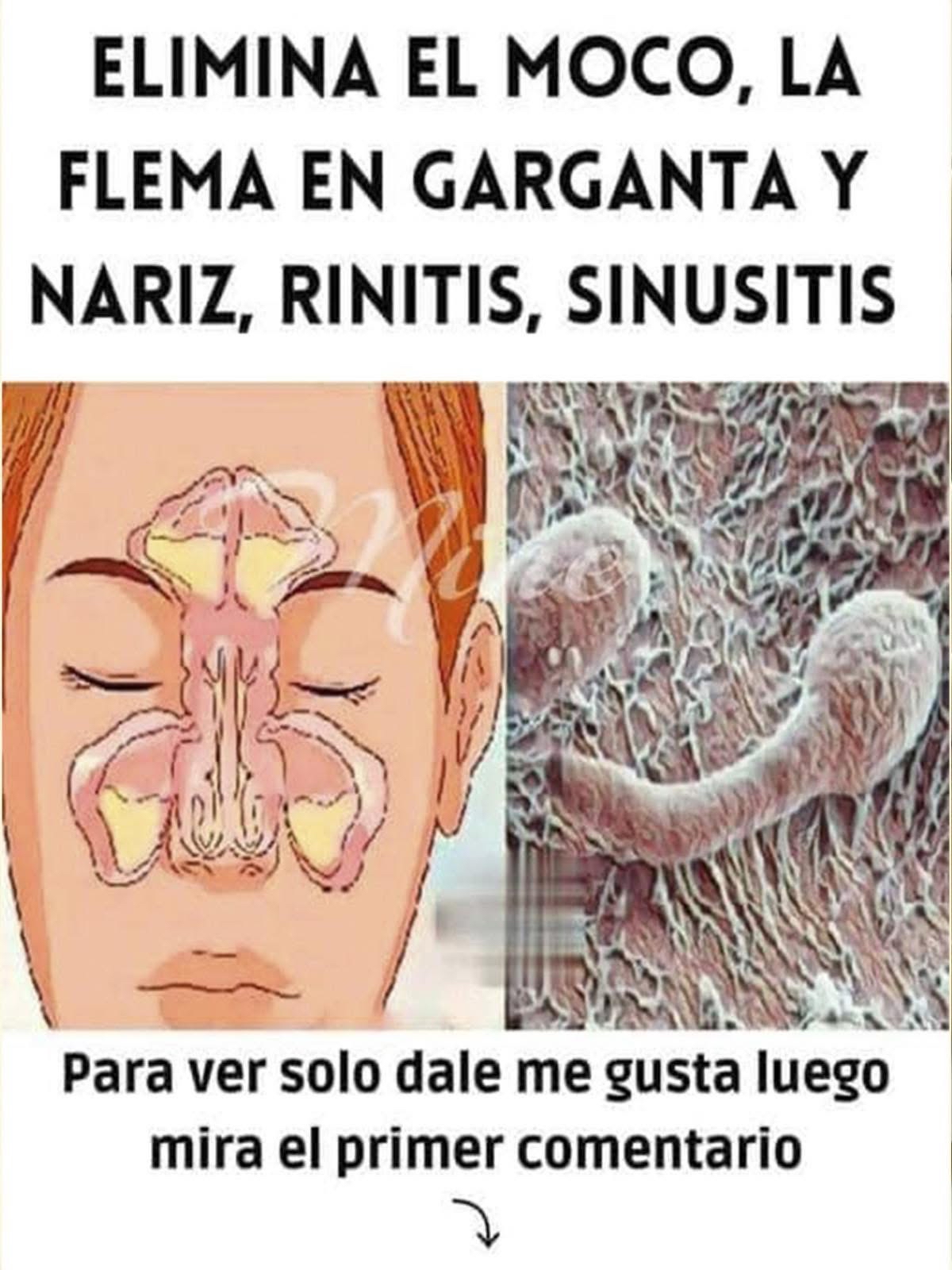 Método natural para eliminar moco y flema