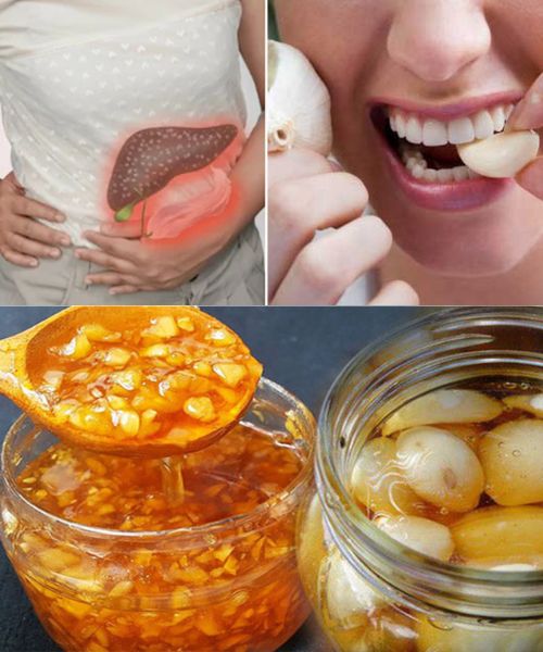 Remedios Naturales para el Hígado