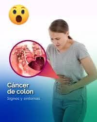 Síntomas del Cáncer de Colon