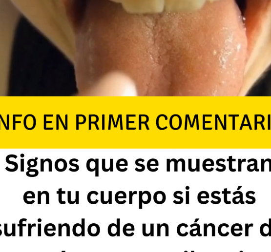 Cáncer de Estómago