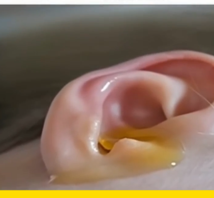 Ingredientes para remedio casero de audición