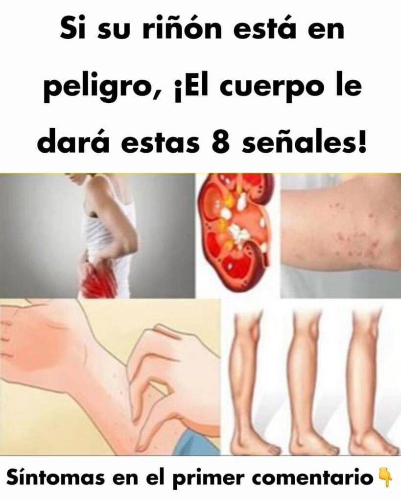 Señales de advertencia de problemas renales