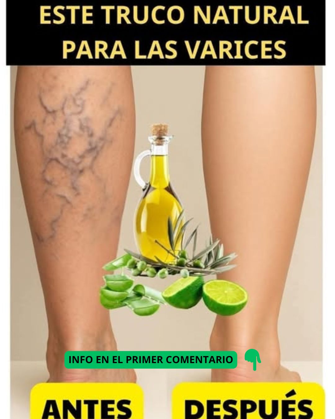 Remedio Natural para Várices