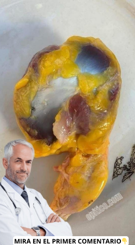 Molleja de Pollo
