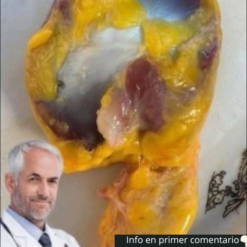 Molleja de pollo