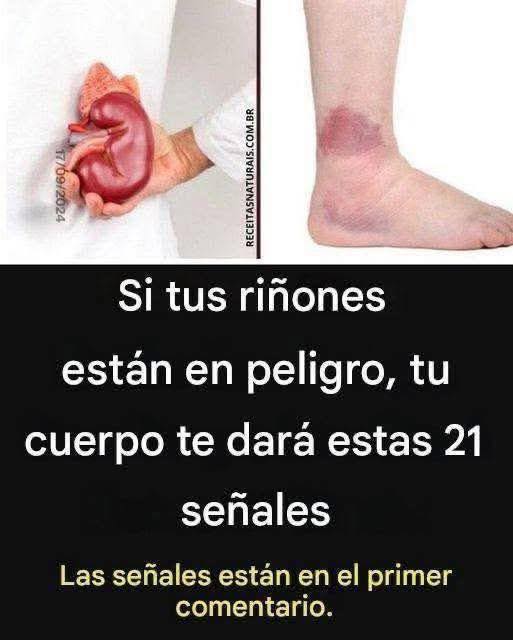 Problemas renales