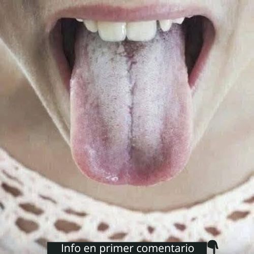 Lengua blanca