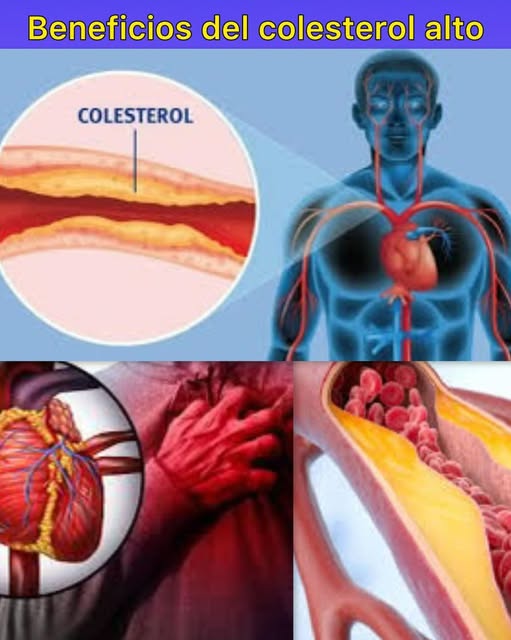 Gráfico sobre colesterol alto