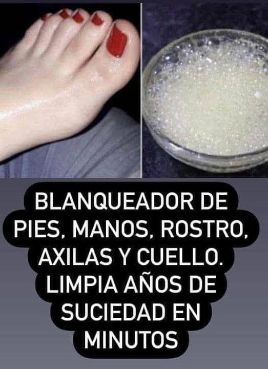 Blanqueador de Pies, Manos y Otras Áreas