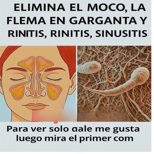 Senos paranasales y cilios de la mucosa nasal