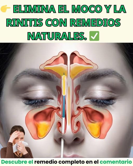 Vías nasales y senos paranasales