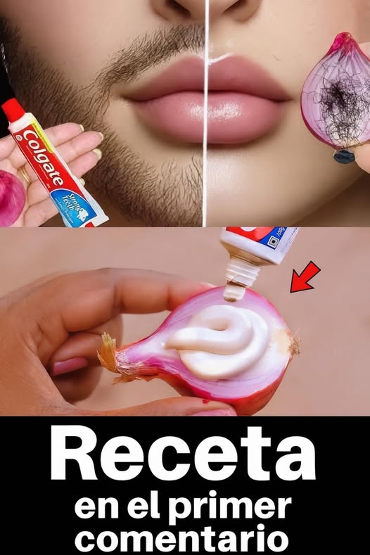 Método casero para eliminar el vello facial