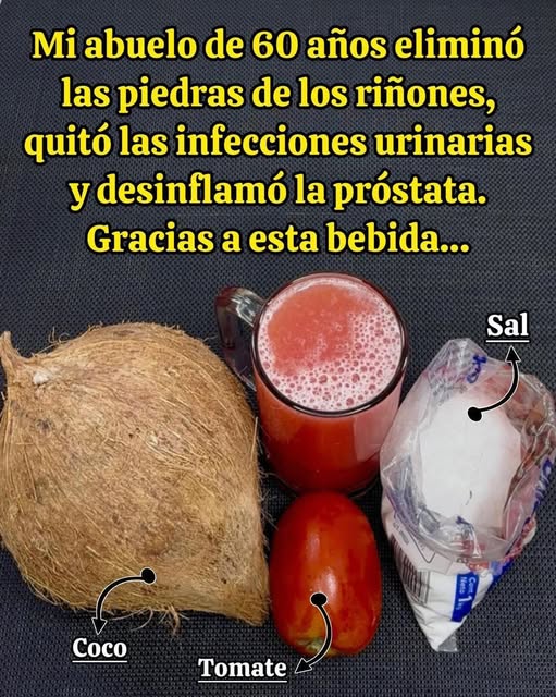 Ingredientes naturales para eliminar piedras de los riñones