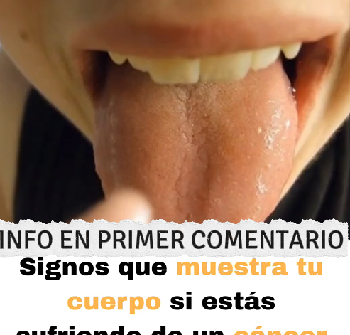 Recetas naturales para la salud del estómago