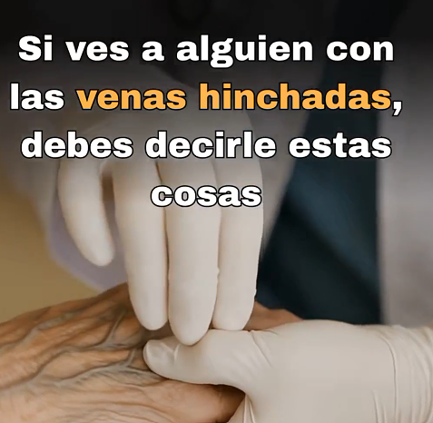 Venas visibles en las manos