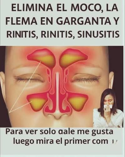 Diagrama de los senos nasales