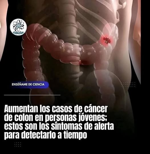 Gráfico del intestino grueso con área problemática destacada
